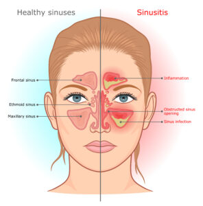anatomy of sinus 